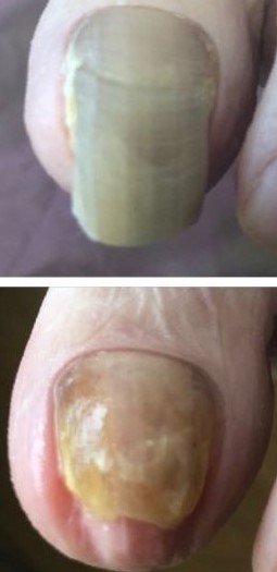 トータルフットケア足助人~あしすけっと~のトッピック画像1