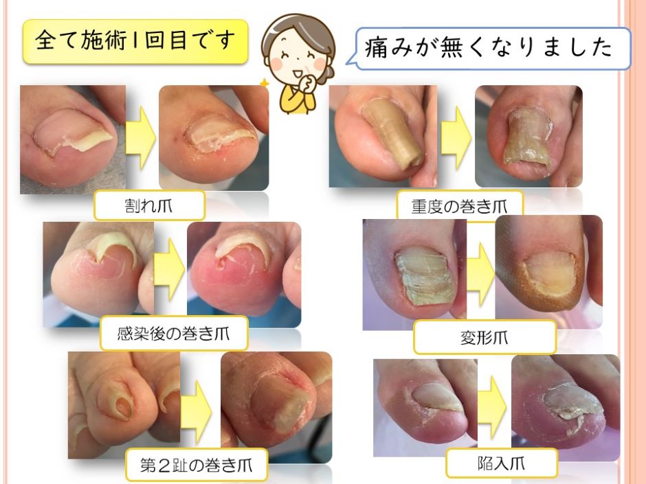 巻爪レスキューつくば ・ ペディグラスつくばの画像
